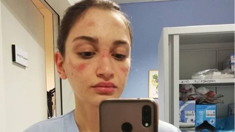 Живеам во спалната, постојано сум со маска: Докторка удри по македонските граѓани