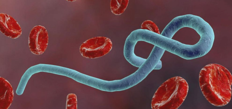 Се шири нов високо заразен вирус: Еве кои се симптомите